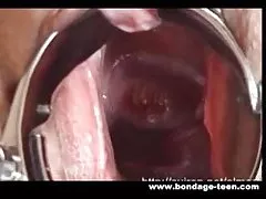 Вытянув зияющую киска мясо с speculum