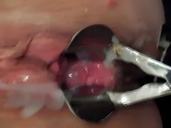 Speculum creampie