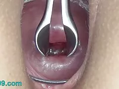 Шейка матки, разводя широкий speculum и спермы в матку